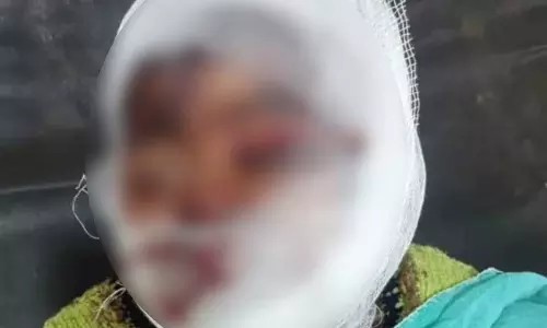 कुत्तों के झुंड ने 7 साल के बच्चे को बनाया निशाना, 107 टांके लगे, 18 घाव...
