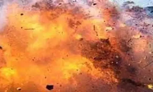 Moradabad: आलू बीन रहे बच्चे के हाथ में फटा देसी बम