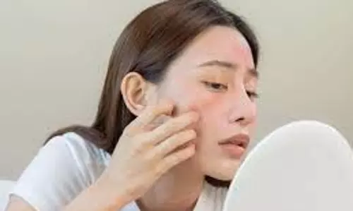 Skin Care: ब्लीचिंग के बाद चेहरे पर होती है जलन तो ये घरेलू उपाय आएंगे काम, तुरंत मिलेगी राहत