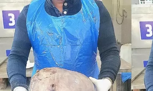 ट्यूमर बढ़ने से फेफड़ों को हुआ नुकसान, महिला की मौत