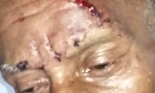 Himachal: आवारा सांडों की लड़ाई में बुजुर्ग व्यक्ति घायल