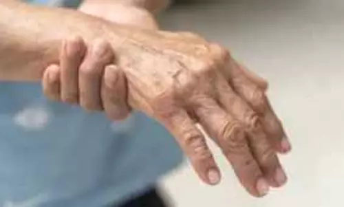 महाराष्ट्र में संदिग्ध जीबीएस से मौतों की संख्या बढ़कर 4 हुई महाराष्ट्र में संदिग्ध जीबीएस से मौतों की संख्या बढ़कर 4 हुई