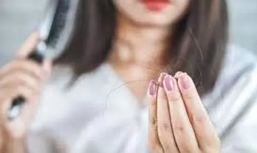 Hair Care: बालों का झड़ना रोकने के  आसान उपाय