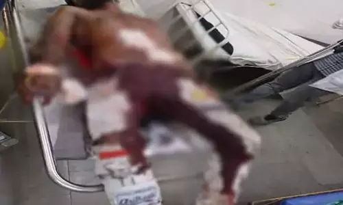 केक काटने के दौरान चला चाकू, अंतड़ियां निकल गई युवक की
