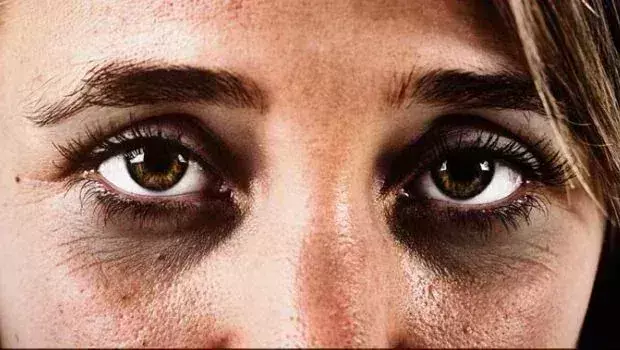 Lifestyle: आँखों में काजल लगाने से होते है डार्क सर्कल, काजल लगाने का सही तरीका जाने Lifestyle: आँखों में काजल लगाने से होते है डार्क सर्कल, काजल लगाने का सही तरीका जाने