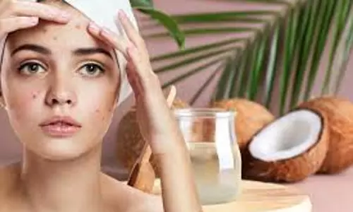 Lifestyle: चेहरे के दाग-धब्बे नहीं जा रहे, नारियल के तेल में मिलाकर लगायें यह चीजें Lifestyle: चेहरे के दाग-धब्बे नहीं जा रहे, नारियल के तेल में मिलाकर लगायें यह चीजें