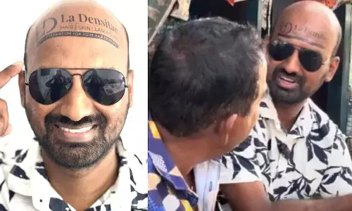 Alappuzha के एक व्यक्ति ने अपने गंजे सिर पर विज्ञापन लगाकर खूब कमाई