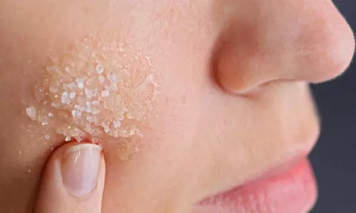 Lifestyle: ठण्ड के मौसम में चेहरे पर जम गई है डेड स्किन, यह खास फेस स्क्रब लगाए