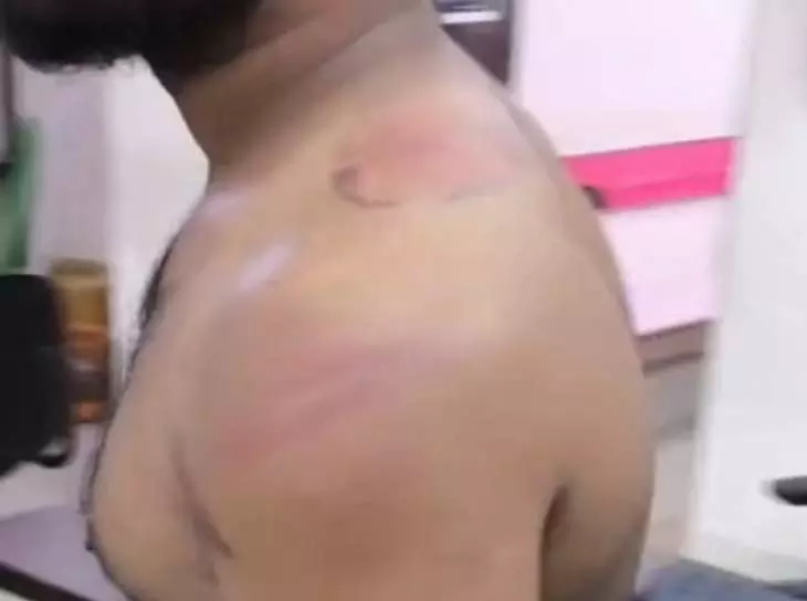 108 एम्बुलेंस का चालक नौकरी से बर्खास्त, मारपीट का आरोप 108 एम्बुलेंस का चालक नौकरी से बर्खास्त, मारपीट का आरोप