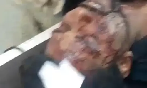 निर्दलीय प्रत्याशी का समर्थक घायल, जानलेवा हमला हुआ