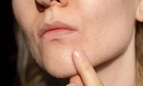 Milk Benefits For Skin: महंगे फेशियल का पैसा बचा सकता है कच्चा दूध, जानें कैसे करें इसका इस्तेमाल