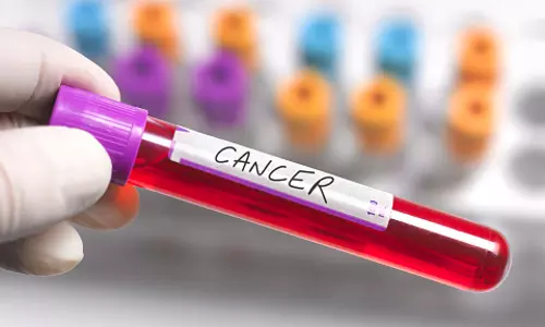 Health News: भारत में अल्कोहल की वजह से बढ़ रहे कैंसर मरीज Health News: भारत में अल्कोहल की वजह से बढ़ रहे कैंसर मरीज