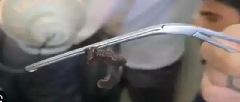 जीएमसी अनंतनाग ने 9 सेमी जोंक को हटाया जीएमसी अनंतनाग ने 9 सेमी जोंक को हटाया