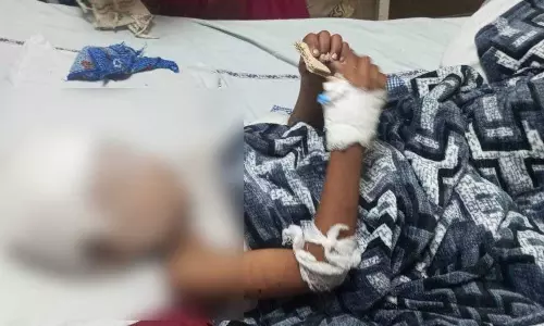 रायपुर: आवारा कुत्तों ने बच्चे को बनाया निशाना, मांस नोंचकर चबाया रायपुर: आवारा कुत्तों ने बच्चे को बनाया निशाना, मांस नोंचकर चबाया