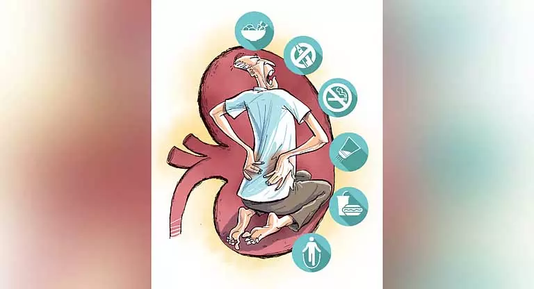 Kerala में बढ़ती लागत से किडनी रोगी परेशान Kerala में बढ़ती लागत से किडनी रोगी परेशान