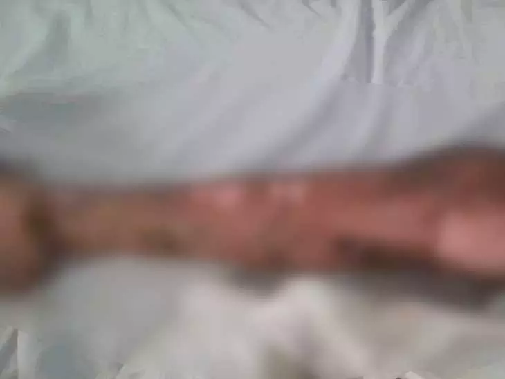 टॉयलेट में ब्लास्ट होने से स्कूल में मचा हड़कंप, छात्रा हुई घायल टॉयलेट में ब्लास्ट होने से स्कूल में मचा हड़कंप, छात्रा हुई घायल