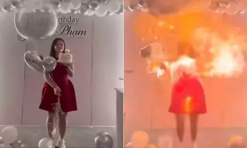 बर्थडे का जश्न मना रही थी लड़की, अचानक हाइड्रोजन से भरे गुब्बारों में लगी आग...