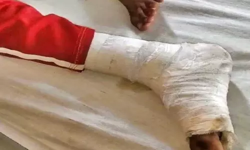 टीचर बच्चे को मुर्गा बनाकर पीठ पर बैठा, इस करतूत से गुस्से में परिजन
