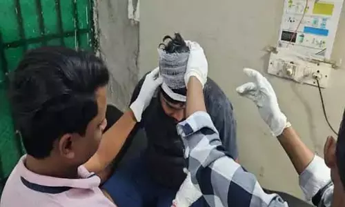 फाइनेंस कर्मचारियों की गुंडागर्दी, हमला कर कस्टमर को किया अधमरा फाइनेंस कर्मचारियों की गुंडागर्दी, हमला कर कस्टमर को किया अधमरा