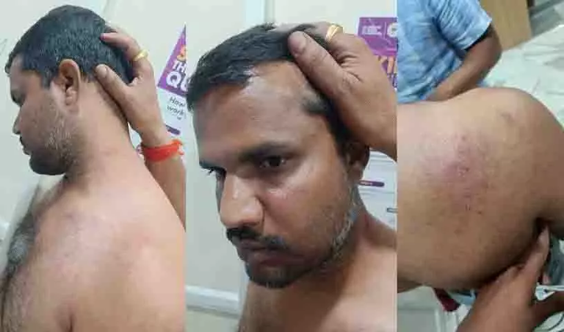 Telangana: बीआरएस नेता पर कांग्रेस कार्यकर्ताओं ने किया हमला Telangana: बीआरएस नेता पर कांग्रेस कार्यकर्ताओं ने किया हमला