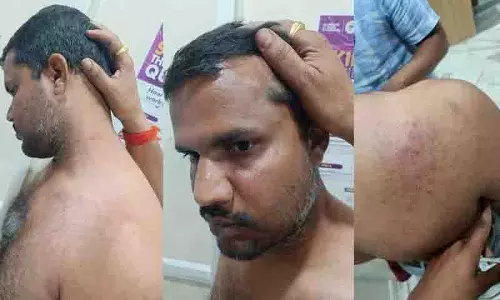Telangana: बीआरएस नेता पर कांग्रेस कार्यकर्ताओं ने किया हमला Telangana: बीआरएस नेता पर कांग्रेस कार्यकर्ताओं ने किया हमला