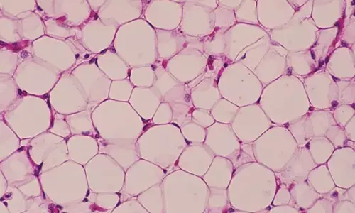Scientists ने मानव पेट में नए प्रकार की वसा का वर्णन किया