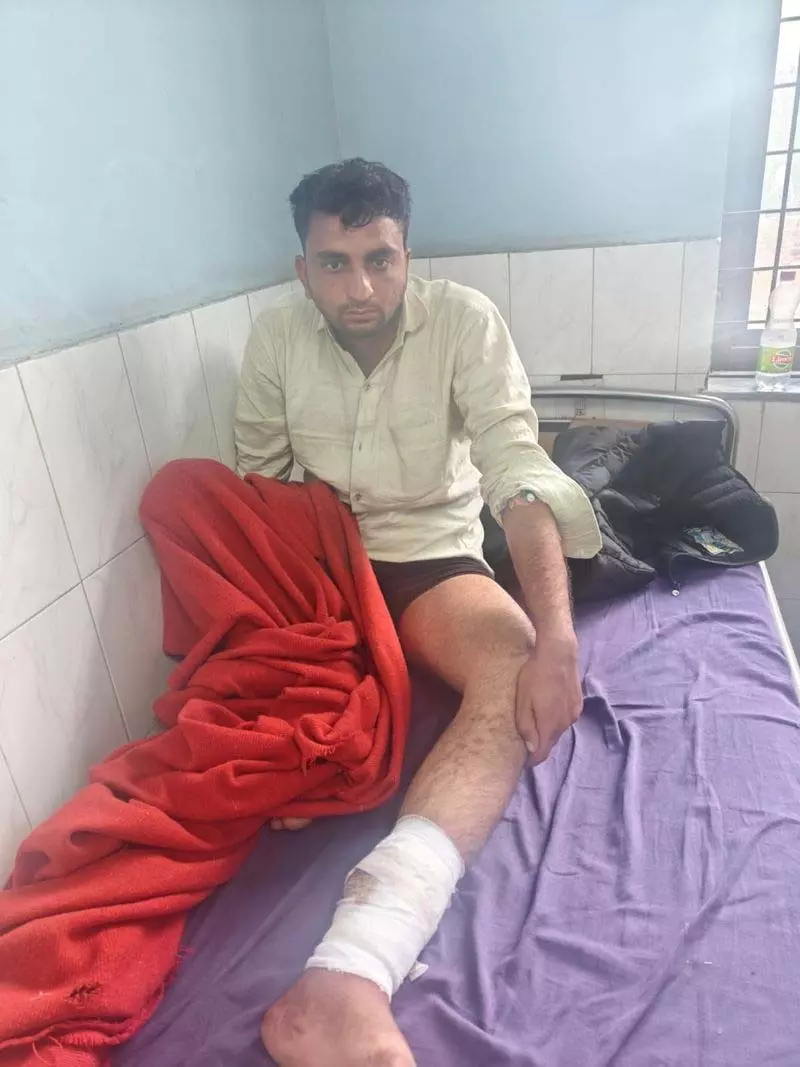 गुरुग्राम पुलिस ने मुठभेड़ के बाद अंतरराज्यीय अपराधी को पकड़ा गुरुग्राम पुलिस ने मुठभेड़ के बाद अंतरराज्यीय अपराधी को पकड़ा