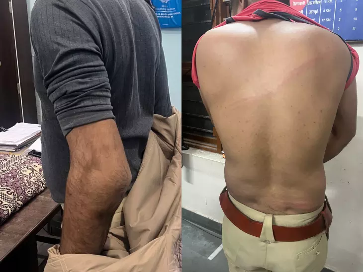 Hanumangarh: लोगों ने गुल्लक चोरी के आरोपी को पकड़ने गई पुलिस पर किया हमला Hanumangarh: लोगों ने गुल्लक चोरी के आरोपी को पकड़ने गई पुलिस पर किया हमला