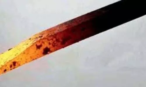 शिशु को गर्म लोहे की छड़ से 40 बार दागा गया शिशु को गर्म लोहे की छड़ से 40 बार दागा गया