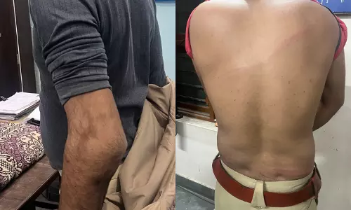 Hanumangarh: लोगों ने गुल्लक चोरी के आरोपी को पकड़ने गई पुलिस पर किया हमला