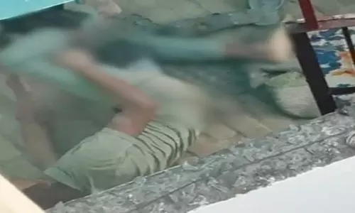 पिटबुल ने युवक को किया लहूलुहान, वीडियो आया सामने