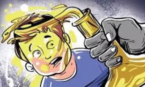 Bareilly: मेडिकल स्टोर संचालक पर तेजाब से हमला, चेहरा जला