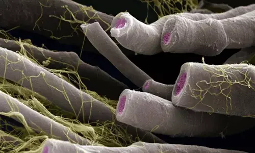 SCIENCE: आंत के बैक्टीरिया का असंतुलन मल्टीपल स्क्लेरोसिस से सम्बंधित