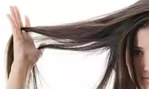 1 करोड़ के बाल चोरी, सीसीटीवी में कैद हुए आरोपी, मचा हड़कंप 1 करोड़ के बाल चोरी, सीसीटीवी में कैद हुए आरोपी, मचा हड़कंप