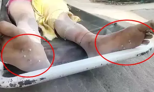 महिला को बेरहमी से उतारा मौत के घाट, तलवे में ठोंकी कीलें