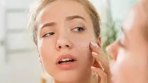 Beauty Tips:चेहरे का रूखापन आपके लुक को खराब कर रहा है तो जरूर आजमाएं ये घरेलू नुस्खे Beauty Tips:चेहरे का रूखापन आपके लुक को खराब कर रहा है तो जरूर आजमाएं ये घरेलू नुस्खे