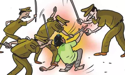 Ballia: पुलिस ने एक पार्टी नेता की बुरी तरह पिटाई की Ballia: पुलिस ने एक पार्टी नेता की बुरी तरह पिटाई की