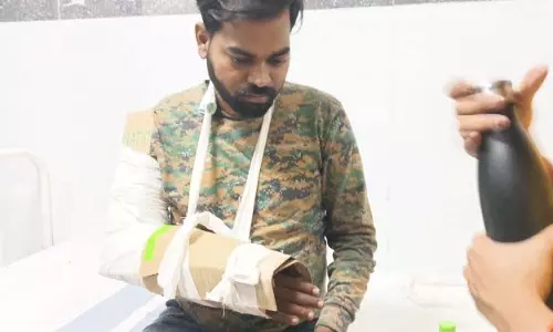 आग बुझाते समय भालू के हमले में वनकर्मी घायल आग बुझाते समय भालू के हमले में वनकर्मी घायल