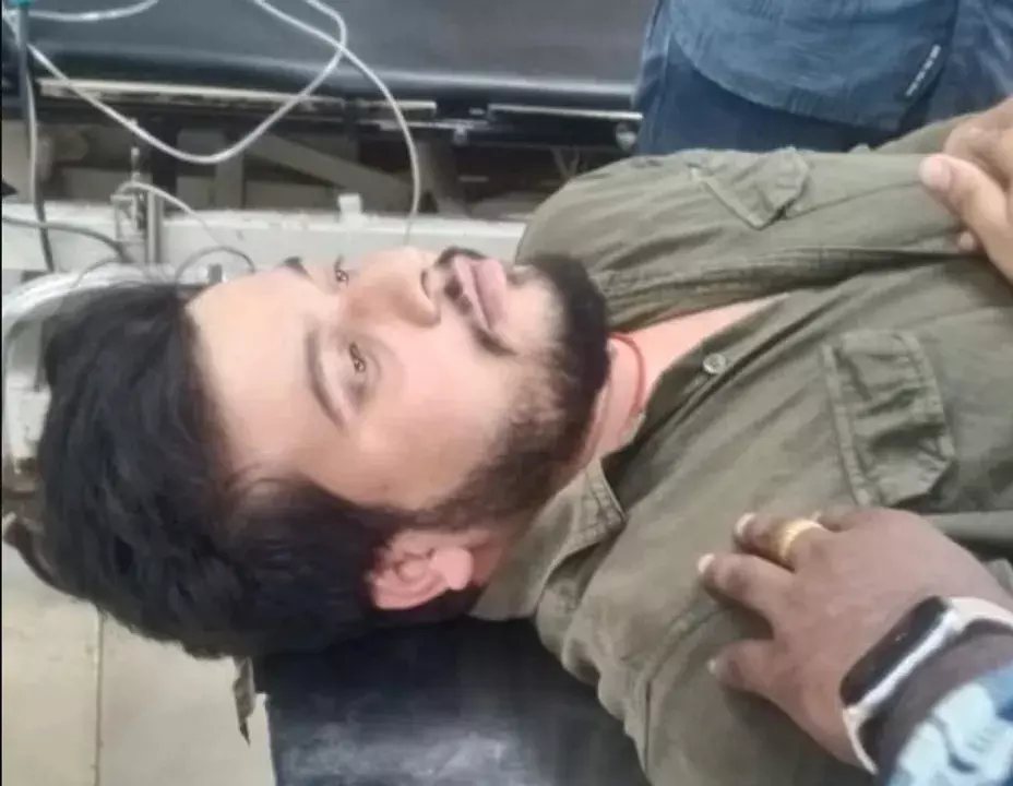 चिपकने वाले पदार्थ का इस्तेमाल कर ATM से पैसे चुराने वाला चोर पुलिस मुठभेड़ में घायल चिपकने वाले पदार्थ का इस्तेमाल कर ATM से पैसे चुराने वाला चोर पुलिस मुठभेड़ में घायल
