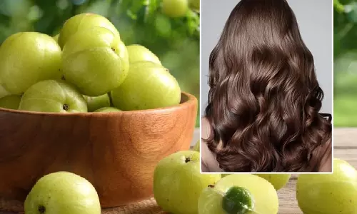 Hair Care: बालों में आंवला लगाने के हैं कई फायदे, लेकिन इन बातों का रखें ध्यान