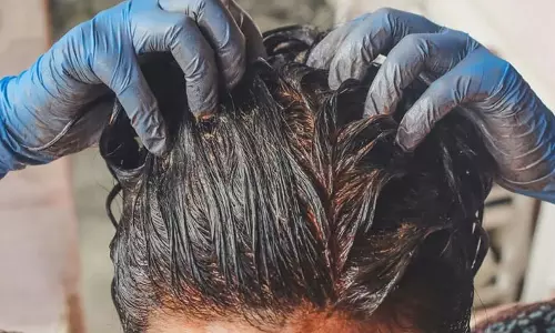 Hair Care: मेहंदी में मिलाकर लगाएं ये 10 रुपए वाली चीज, बाल हो जाएंगे प्राकृतिक रूप से काले और चमकदार Hair Care: मेहंदी में मिलाकर लगाएं ये 10 रुपए वाली चीज, बाल हो जाएंगे प्राकृतिक रूप से काले और चमकदार