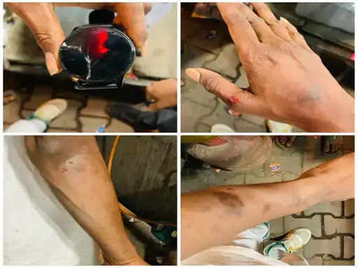 रायपुर : कांस्टेबल ने तू-तड़ाक करते थप्पड़ जड़ा, चाय वाले के भाई का आरोप रायपुर : कांस्टेबल ने तू-तड़ाक करते थप्पड़ जड़ा, चाय वाले के भाई का आरोप