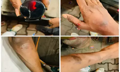 रायपुर : कांस्टेबल ने तू-तड़ाक करते थप्पड़ जड़ा, चाय वाले के भाई का आरोप