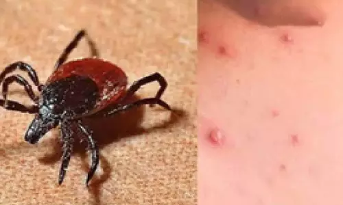 ग्रामीण समुदायों में स्क्रब टाइफस संक्रमण का खतरा अधिक- Study ग्रामीण समुदायों में स्क्रब टाइफस संक्रमण का खतरा अधिक- Study