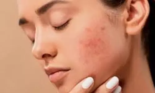 Skin Care: रूखी त्वचा को हाइड्रेट करने के लिए अपनाएं ये  जरूरी उपाय