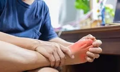 Health: यूरिक एसिड को जड़ से खत्म कर सकते हैं ये घरेलू उपाय