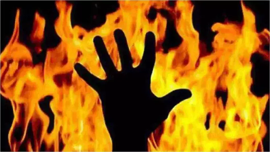 NCR Loni: पति पर पेट्रोल डालकर आग लगाने का आरोप