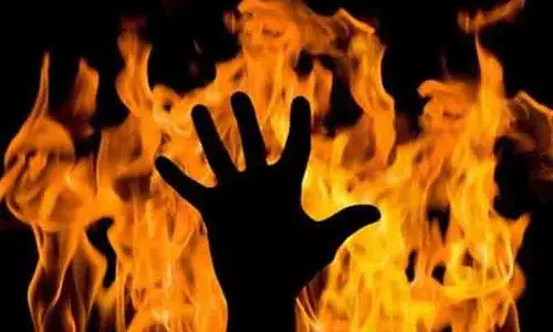 Hyderabad में पति द्वारा आग लगाने के बाद महिला की जलकर मौत Hyderabad में पति द्वारा आग लगाने के बाद महिला की जलकर मौत