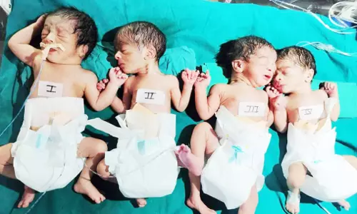 महिला ने एक साथ 4 बच्चों को दिया जन्म, सभी स्वस्थ महिला ने एक साथ 4 बच्चों को दिया जन्म, सभी स्वस्थ