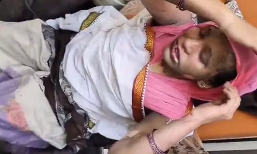 पति से विवाद के बाद पत्नी ने खुद को आग लगाई, इलाज के दौरान मौत